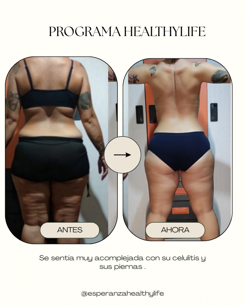 Beige Minimalist Bold Beauty Skincare Before After Collage Instagram Post - 4